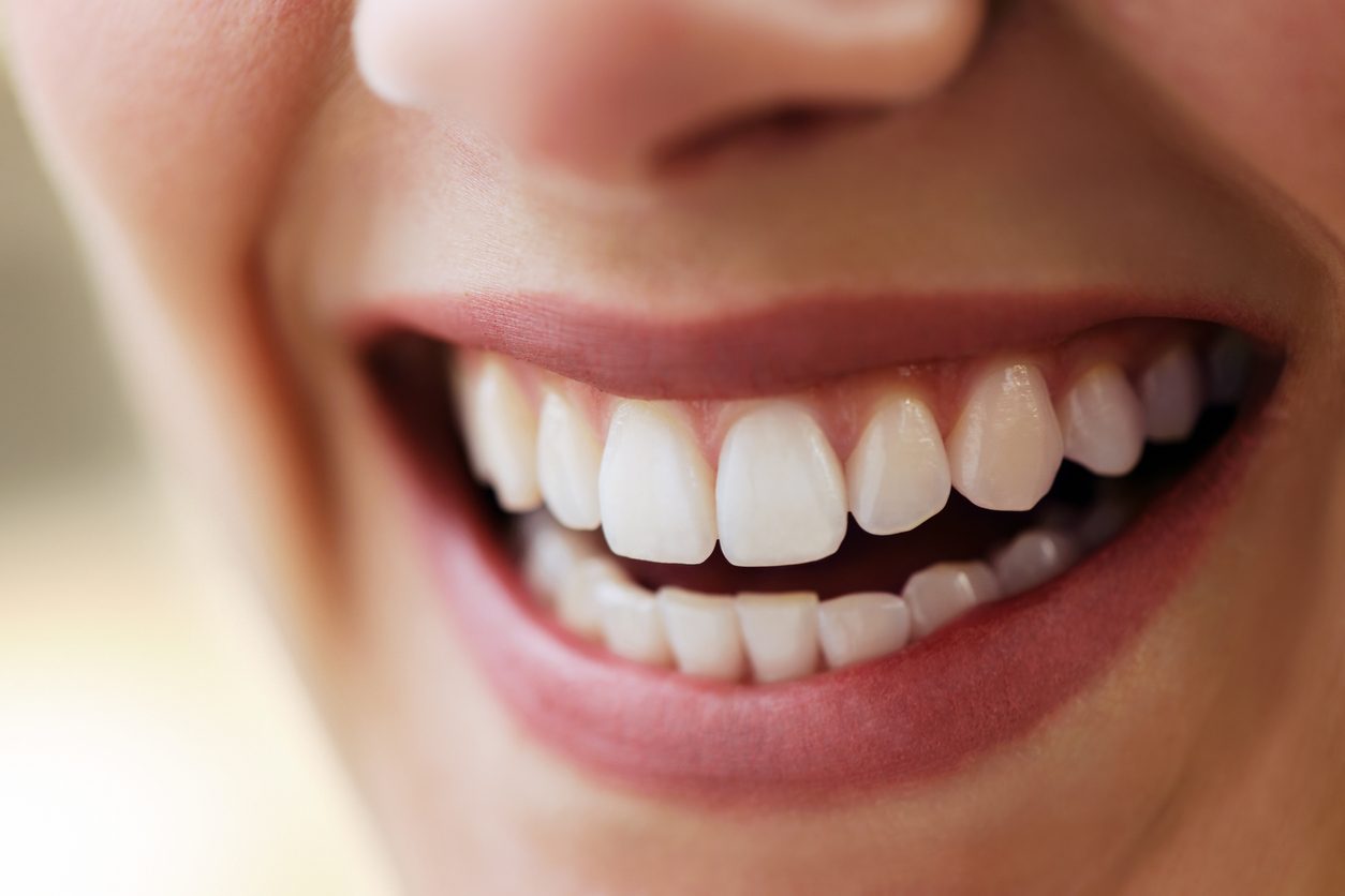 الأسنان الصفراء \ iStock
