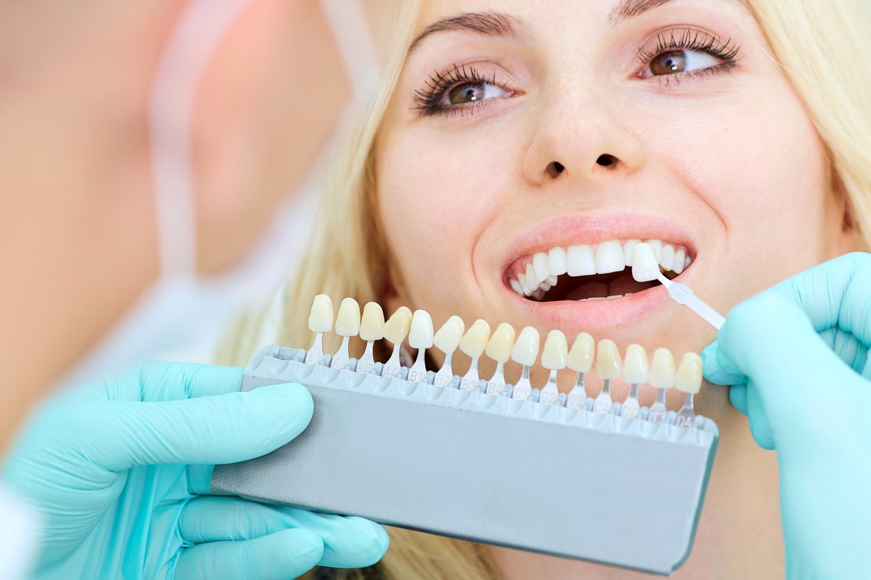 الأسنان الصفراء \ iStock