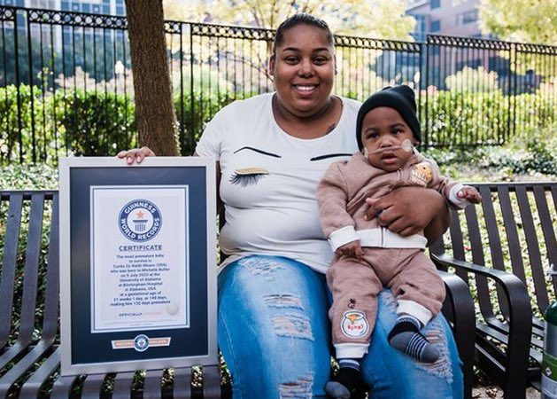 طفل أمريكي يحصل على لقب “أصغر رضيع يولد قبل أوانه عالمياً”.. الأطباء قالوا إن نجاته “أعجوبة” (فيديو)