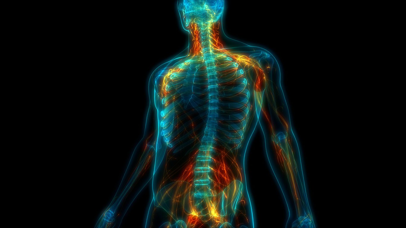 iStock/ التهاب الأعصاب