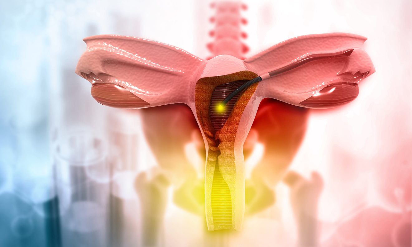 أمراض المهبل \ iStock