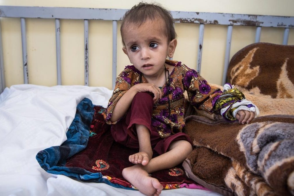 كابول مستشفيات أطفال