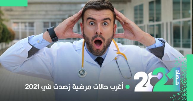 رجل يحمل قطعة أسمنت في قلبه وصبي بلسان أصفر.. أغرب حالات مَرضية في عام 2021