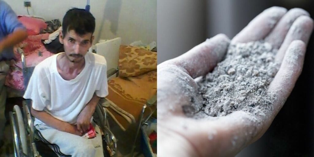 مرض السيليكوز