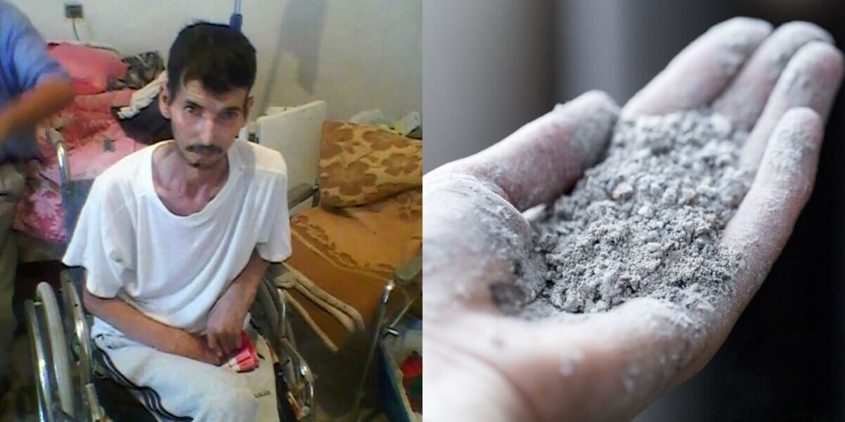 مرض السيليكوز