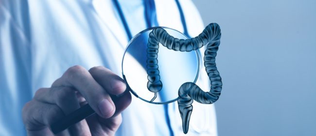 التهاب مزمن لا علاج له وقد يسبب مشاكل الهضم وآلام المعدة.. أسباب التهاب القولون التقرحي