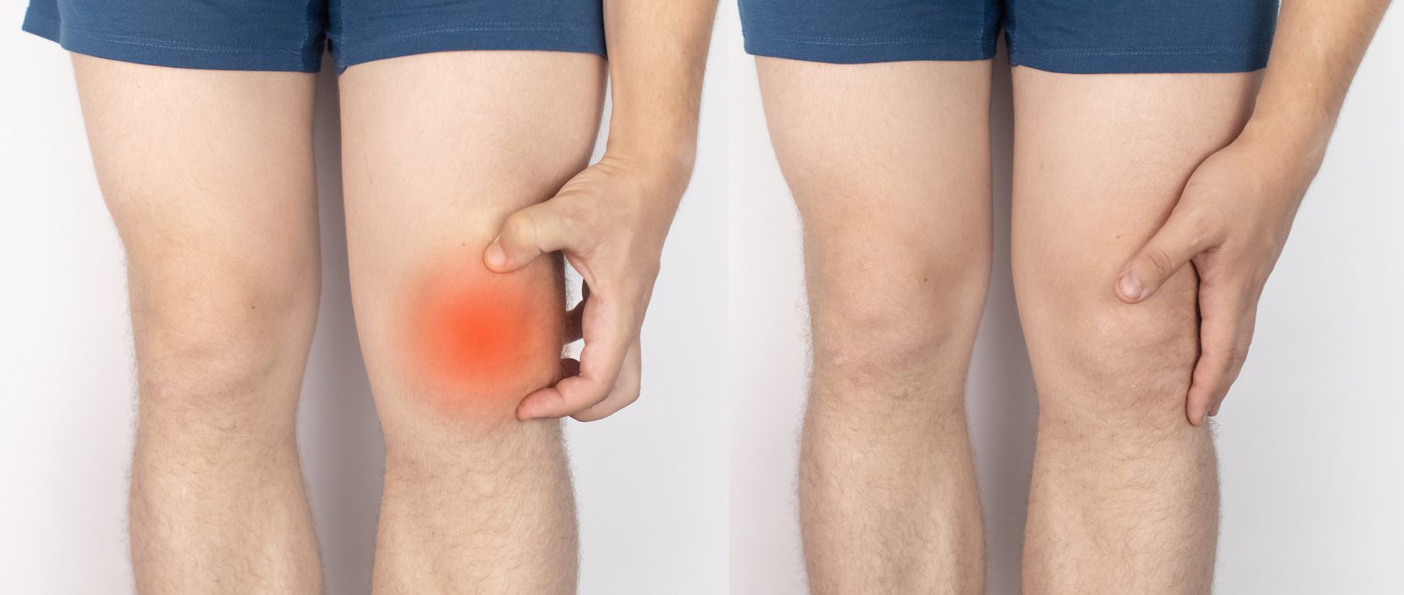 احتباس السوائل \ istock
