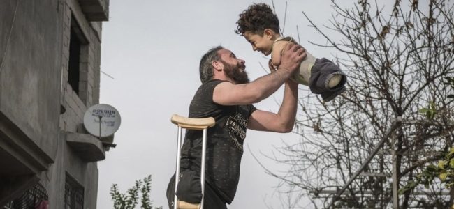 الطفل السوري مصطفى النزال يصل إيطاليا لتلقي العلاج.. صورته هزت العالم وأثارت تعاطفاً واسعاً (فيديو)