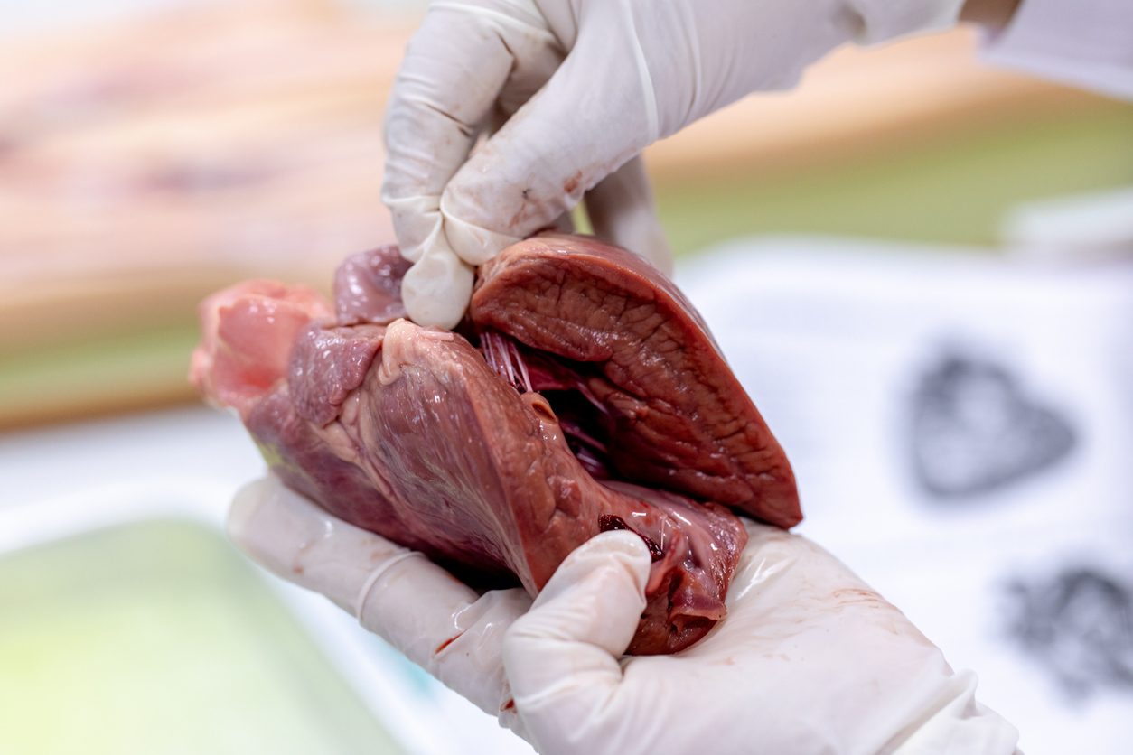 طبيب باكستاني اخترع تقنية جعلت الأمر ممكناً.. لِمَ اختير قلب “الخنزير” لزراعته في الجسم البشري؟