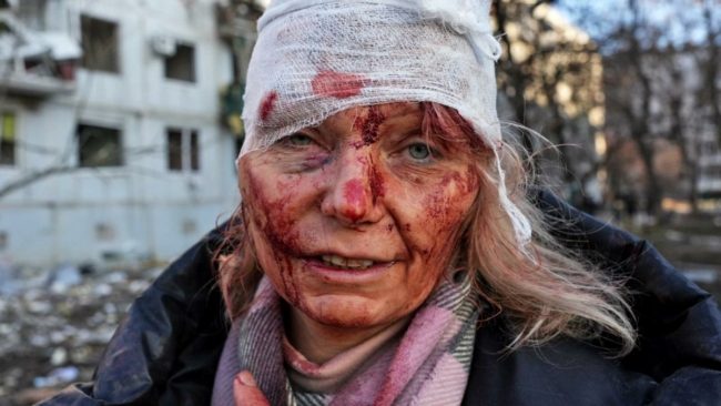 “أفضِّل الموت على الخضوع لبوتين”.. المعلمة الأوكرانية التي تحوَّلت لرمز الحرب تروي قصة نجاتها من الموت