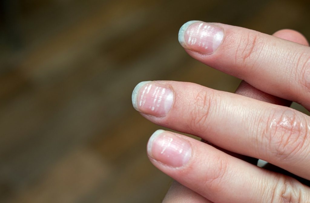 iStock/ أطعمة لزيادة نسبة الحديد من أجل علاج فقر الدم