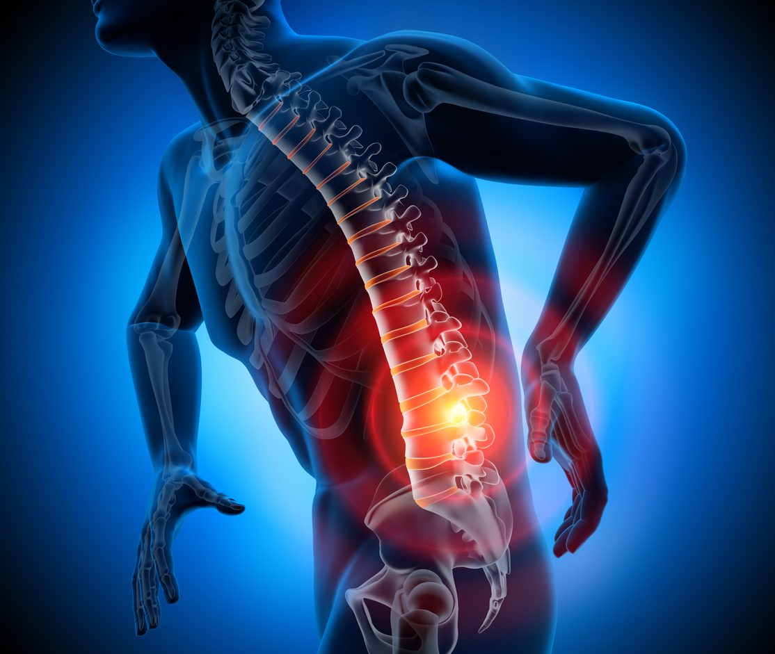 انزلاق الغضروف iStock