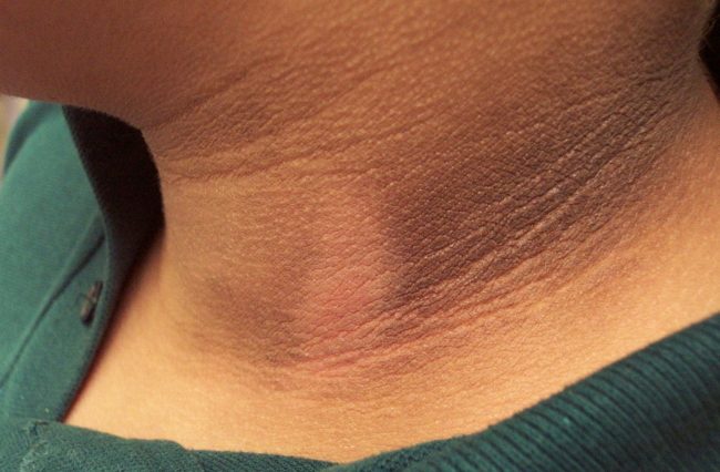 مشكلة اسمرار الرقبة.. 6 منتجات ينصح بها خبراء الجلدية لعلاجها