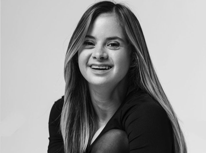 متلازمة داون