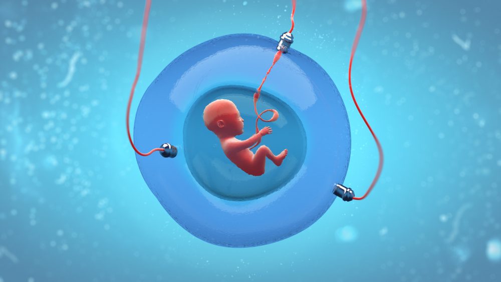 عدم ظهور كيس الحمل - Shutterstock<br>