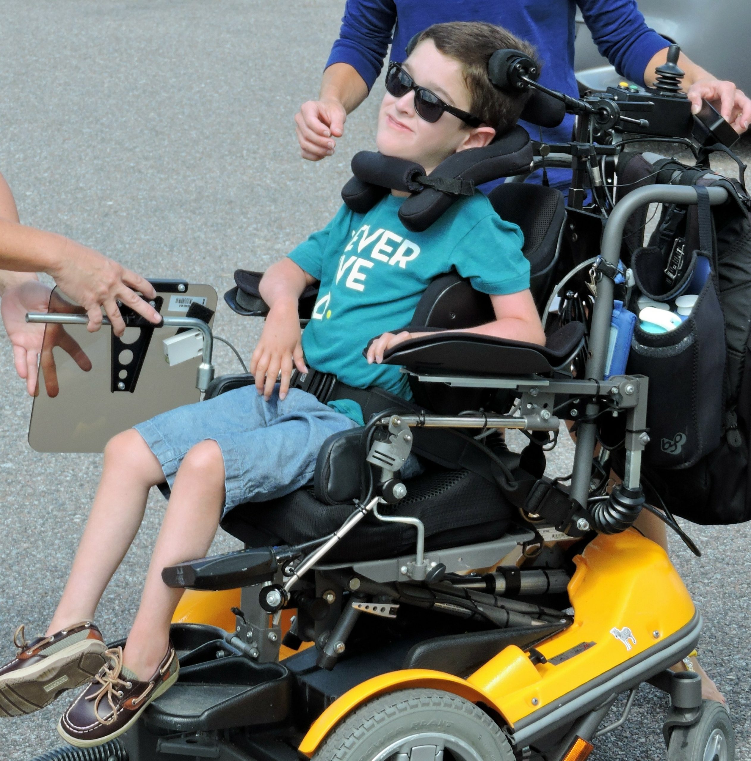 مرض- ضمور العضلات الشوكي