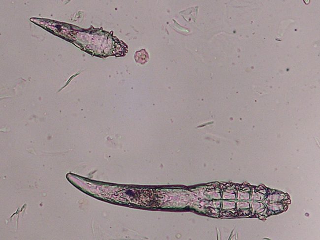 تتزاوج على جبهاتنا وأنوفنا في الليل! دويدة تعتمد على جسد الإنسان تواجه خطر الانقراض