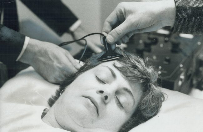 العلاج بالصدمات الكهربائية وآثاره على الدماغ وسوء استخدامه تثير الجدل من جديد بين الأطباء