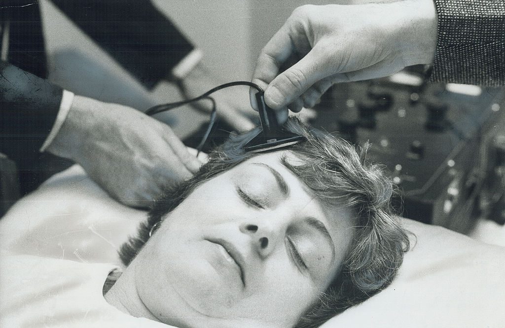 العلاج بالصدمات الكهربائية وآثاره على الدماغ وسوء استخدامه تثير الجدل من جديد بين الأطباء