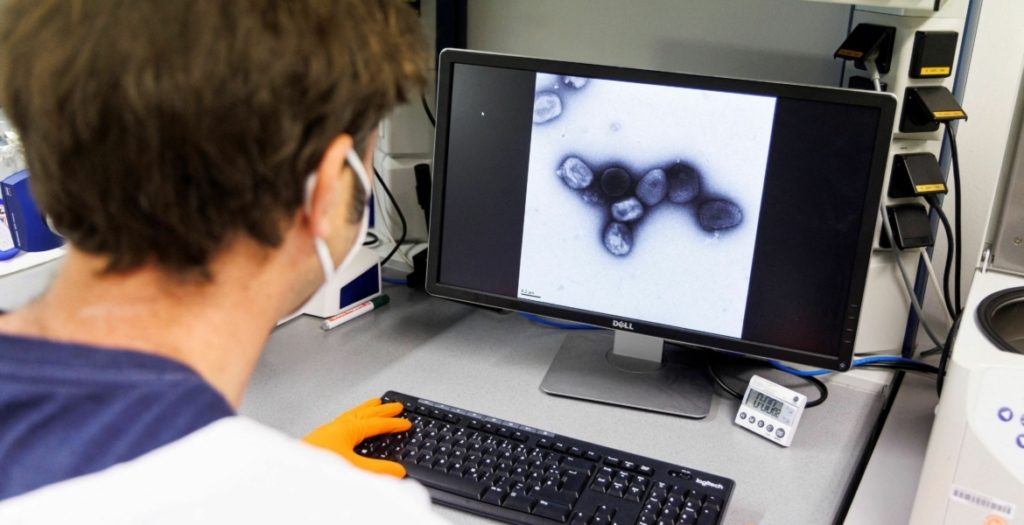 جدري القرود