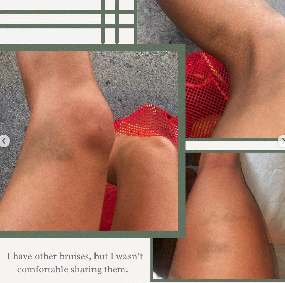 سباحة كندية ألمانيا 