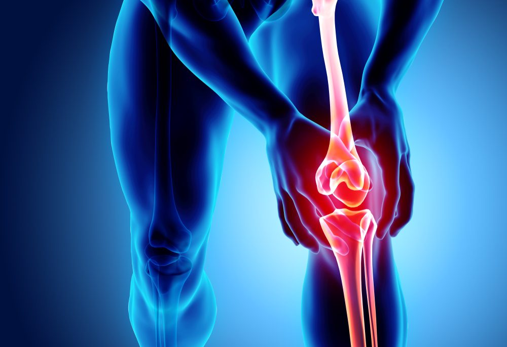 تسبب الحالة الألم وصعوبة الحركة والتورُّم - ShutterStock