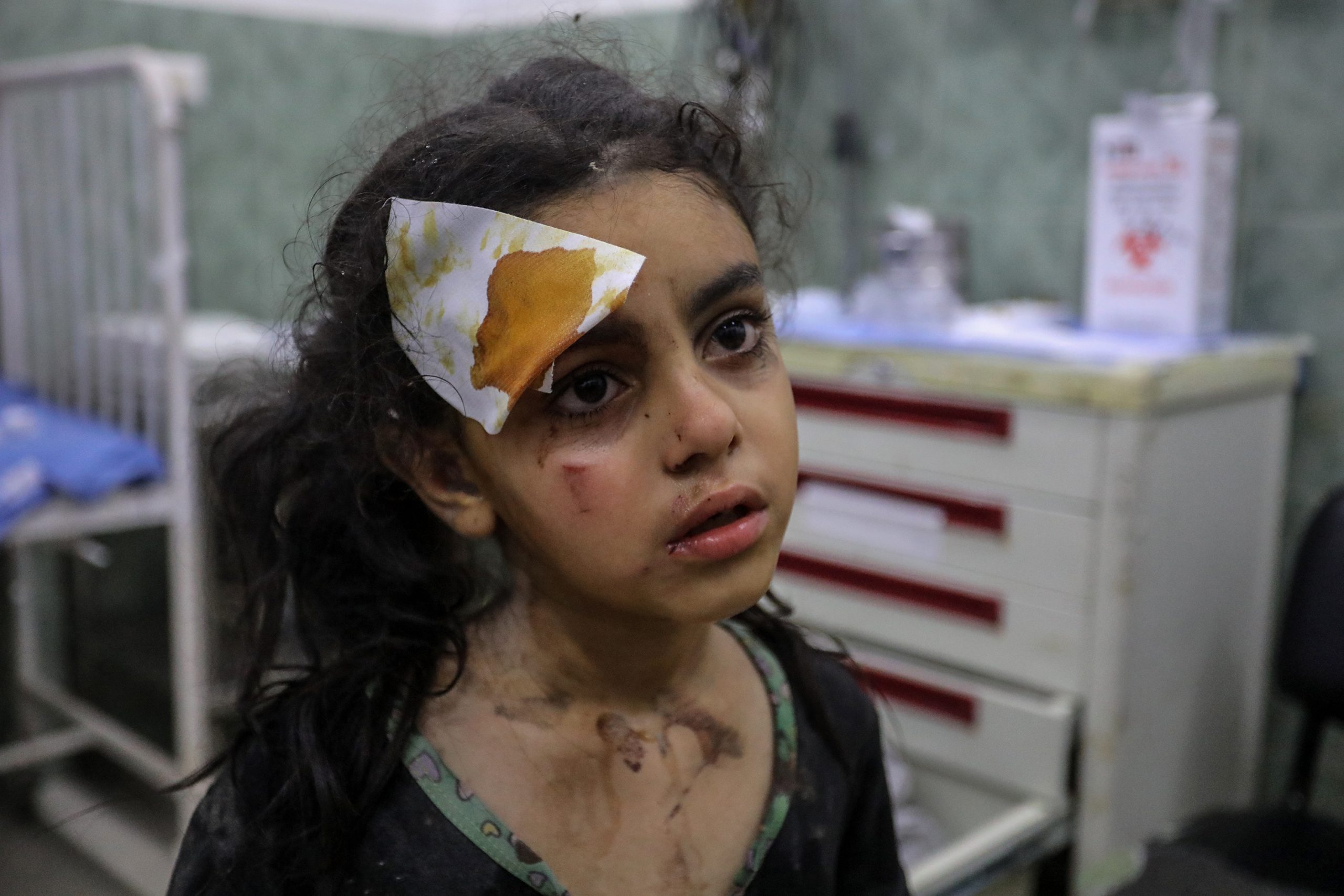 الطفلة الفلسطينية المصابة في رفح/ الأناضول