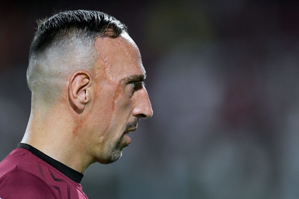 آثار الحادث ما زالت واضحة على وجه اللاعب الفرنسي/ Getty Images