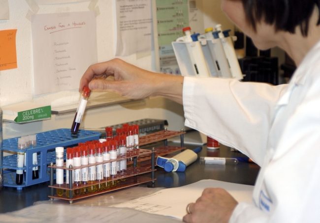 رصد السرطان قبل سنوات من الإصابة به.. علماء يبدأون تجارب لرصد المؤشرات المبكرة للمرض الخبيث