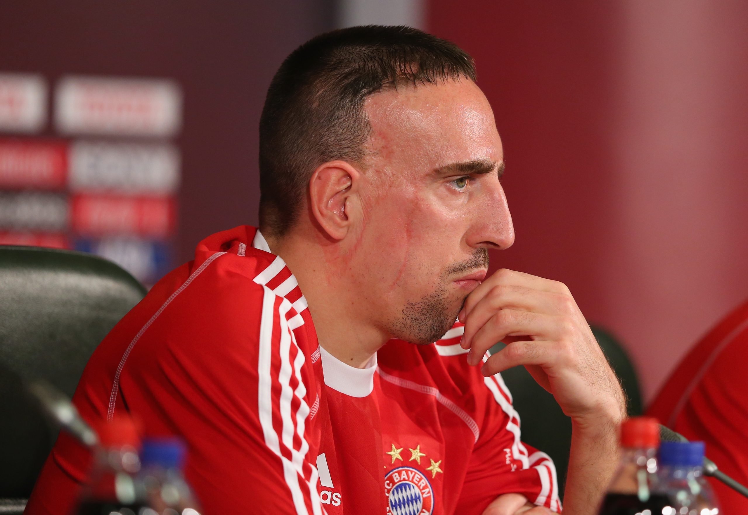 سر الندوب في وجه فرانك ريبيري - gettyimages