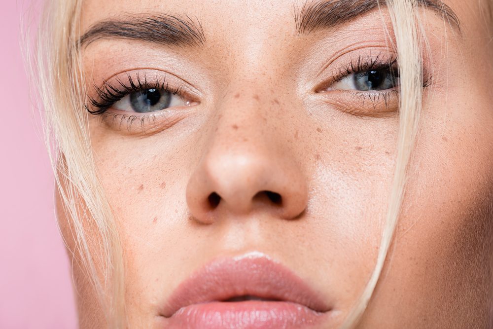 بعض صيحات التجميل تتعمد رسم النمش ضمن صيحات الجمال - ShutterStock