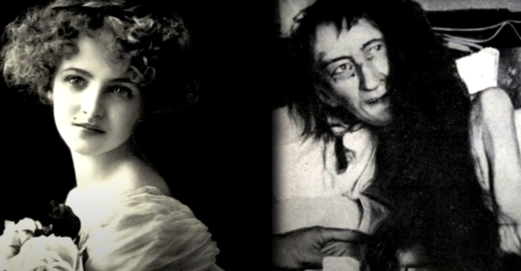 بلانش مونييه.. الفرنسية الفاتنة التي قيَّدتها أمها في السرير لـ25 عاماً وادَّعت وفاتها بسبب قصة حب!