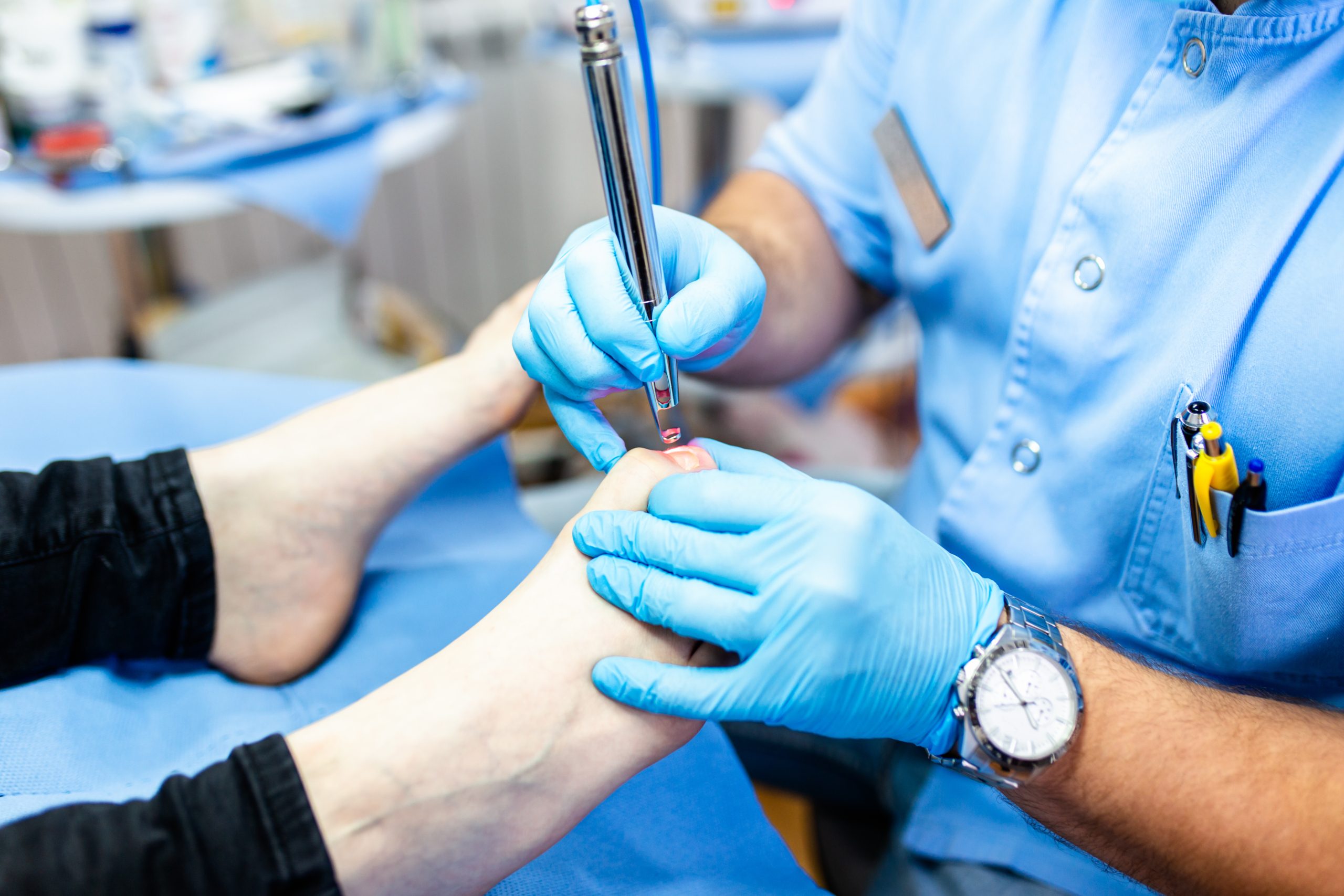 فطريات الأظافر