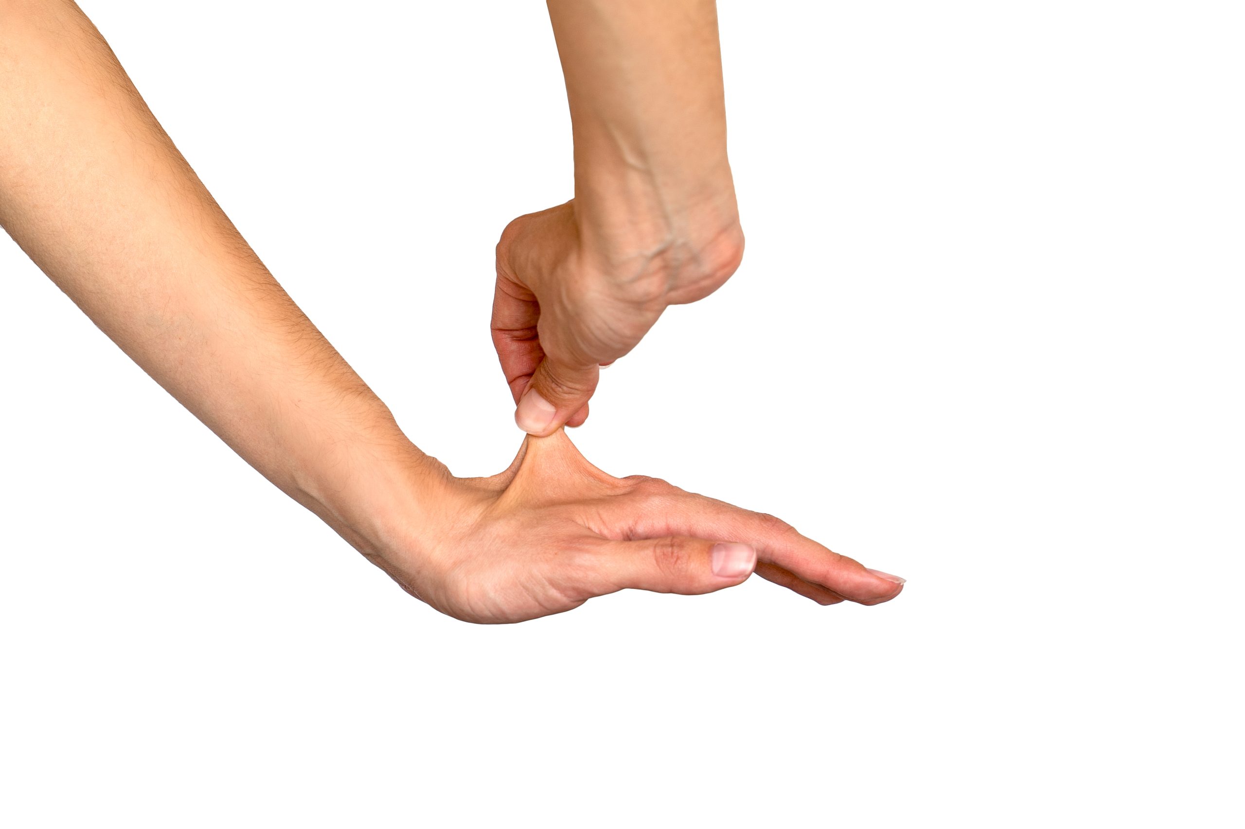مرونة الجلد بسبب متلازمة إهلرز دانلوس|shutterstock