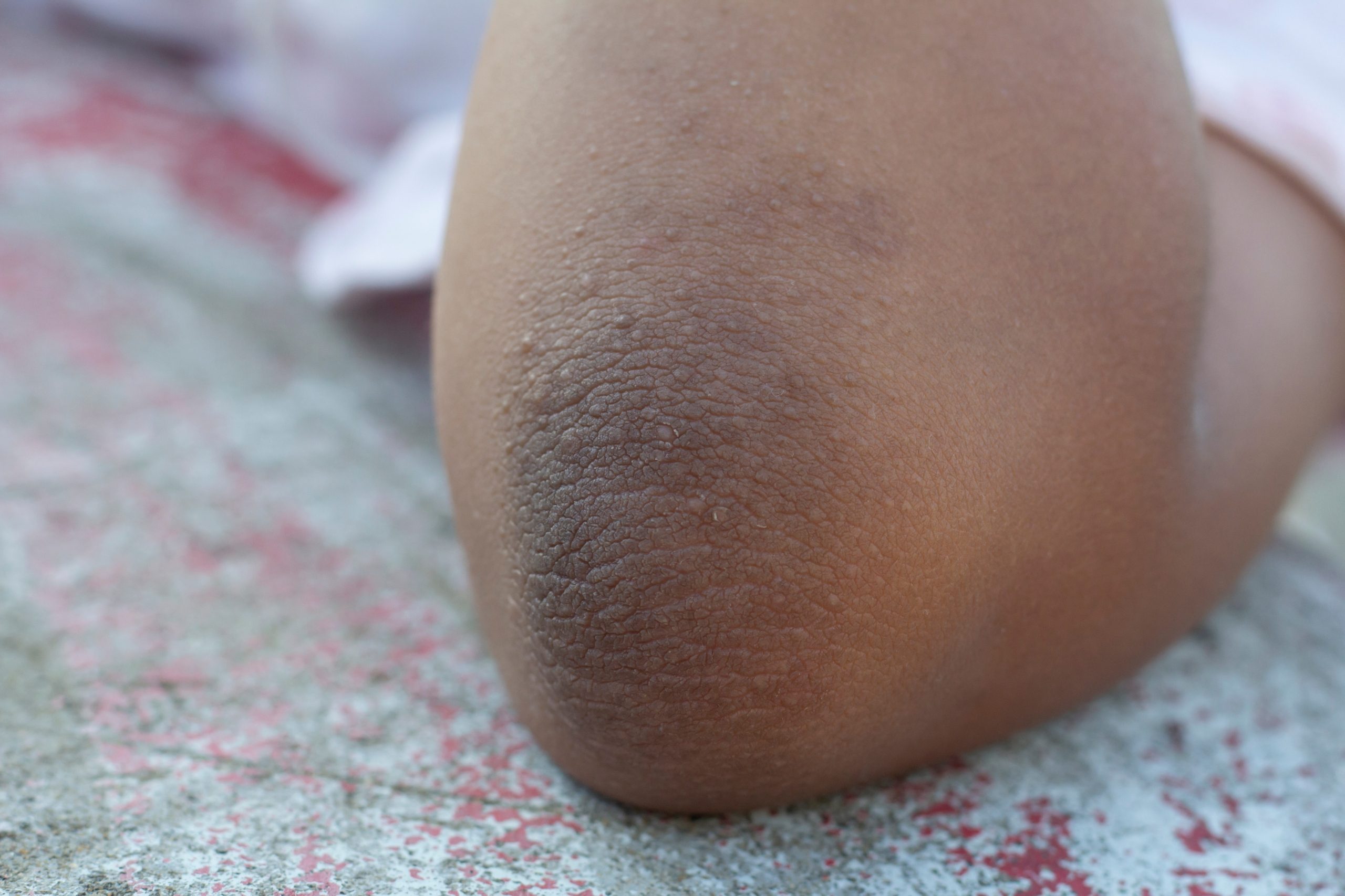 Shutter Stock/ الشواك الأسود