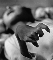 مرض ميناماتا