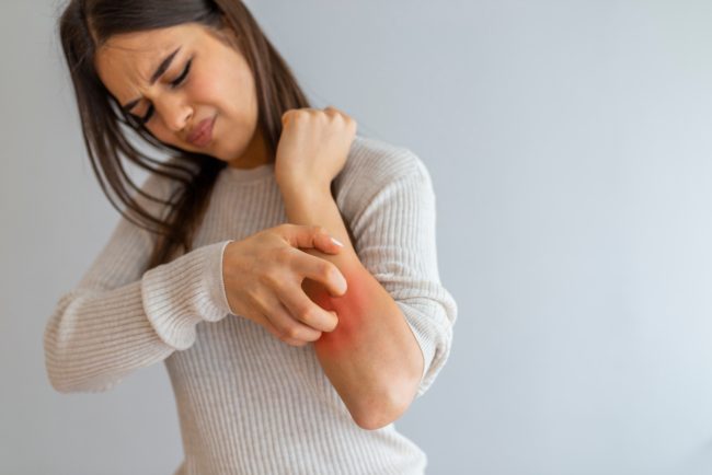 من بينها البابونج والألوفيرا.. 5 أعشاب تساعد على التقليل من أعراض حساسية الجلد