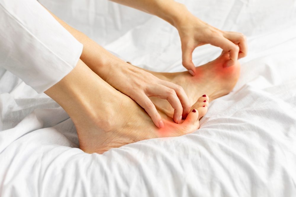 الجساسية الجلدية ومشاكل الالتهابات قد تؤدي لحكة القدم - ShutterStock