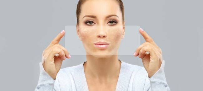 التقشير الكيميائي للجلد.. أنواعه وفوائده وأضراره المحتملة