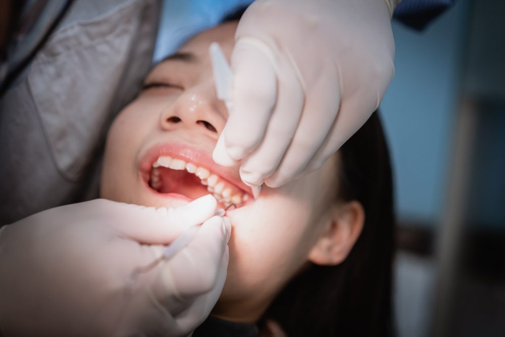 يمكن للطبيب المتخصص إجراء عملية إزالة الضرس المطمور - Shutterstock
