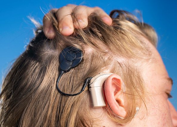 متلازمة بيندريد