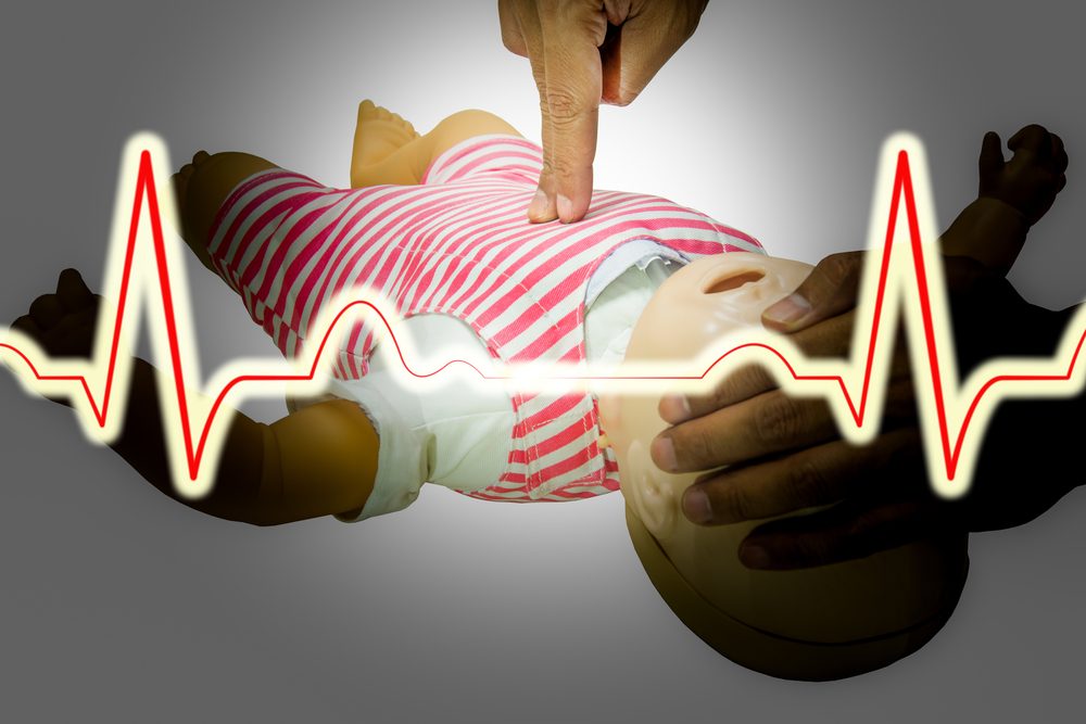 يجب تطبيق الخطوات لحين وصول الإسعاف الطبي المتخصص - Shutterstock