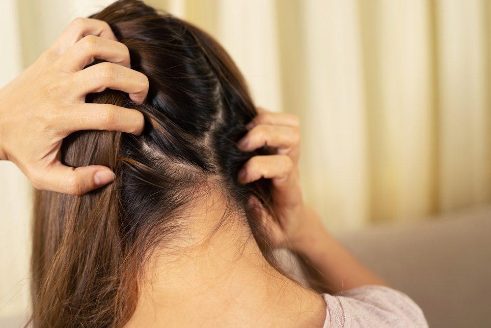 بصيلات الشعر