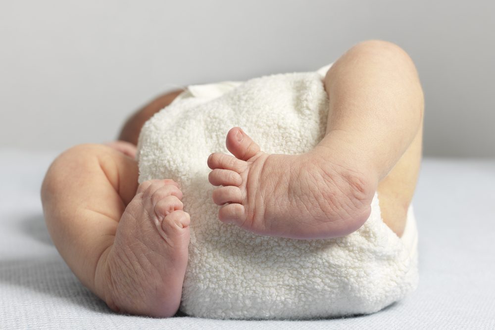 متلازمة الجلد المتجعد، صورة تعبيرية| shutterstock