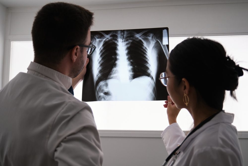 يتكون القفص الصدري من 12 ضلعاً على كل جانب - ShutterStock