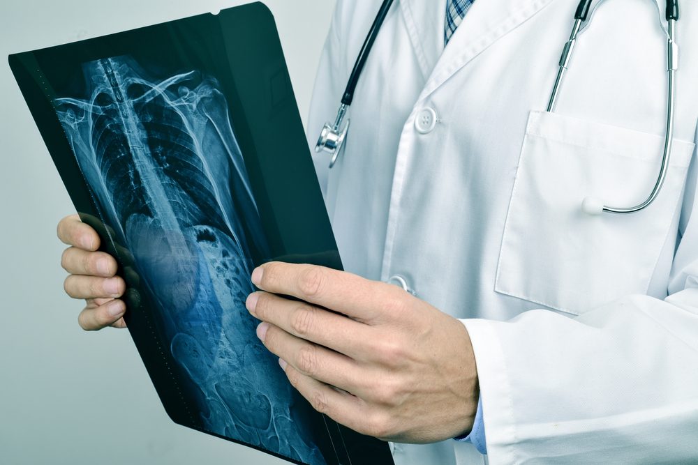 قد يحتاج الطبيب إلى إجراء اختبار بالأشعة المقطعية لتشخيص الحالة - ShutterStock