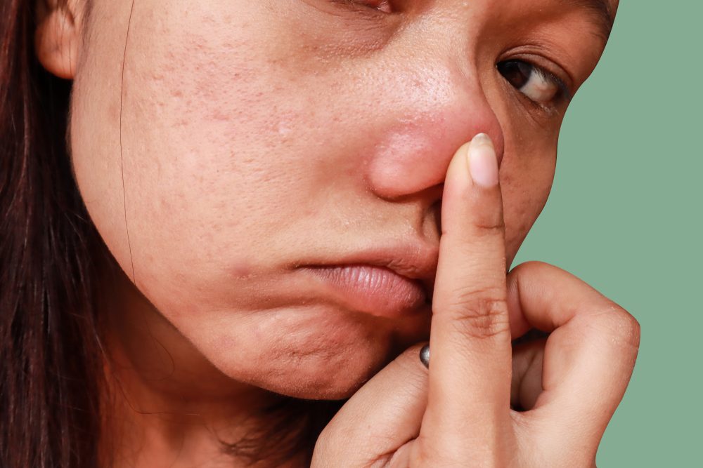 مثلث الموت في الوجه| shutterstock
