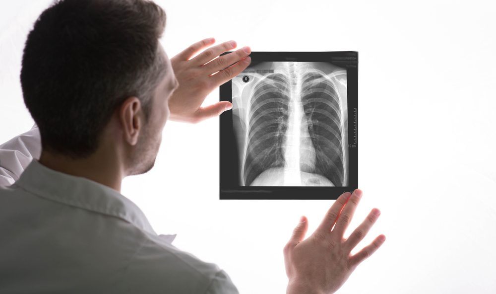 الأورام الحبيبية