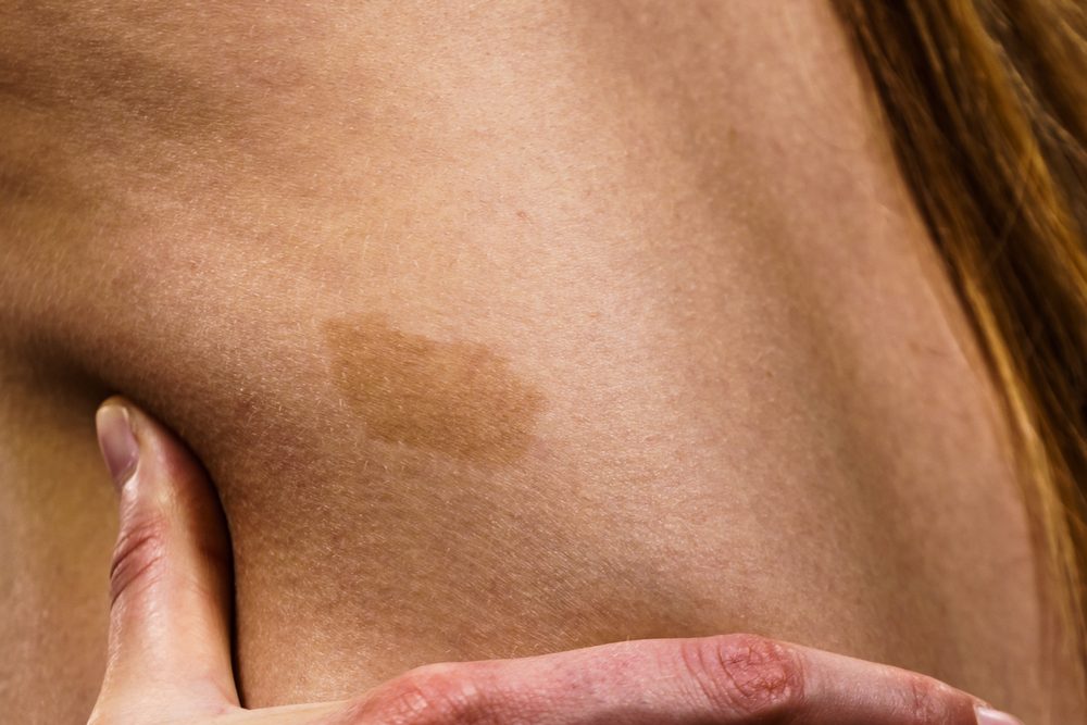 Shutter Stock/ بقع القهوة بالحليب