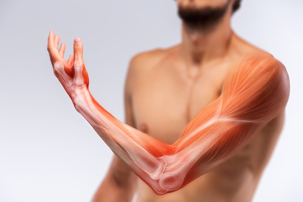 على الرغم من أعراضها القوية، لا يزال الطب غير قادر على تحديد أسبابها - ShutterStock